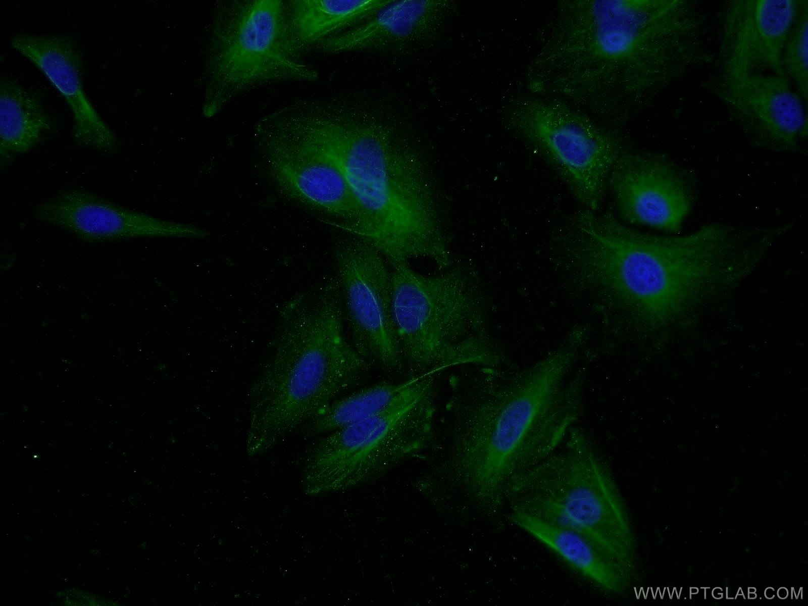 Immunofluorescence (IF) / fluorescent staining of A549 cells using IDO2 Polyclonal antibody (25053-1-AP)