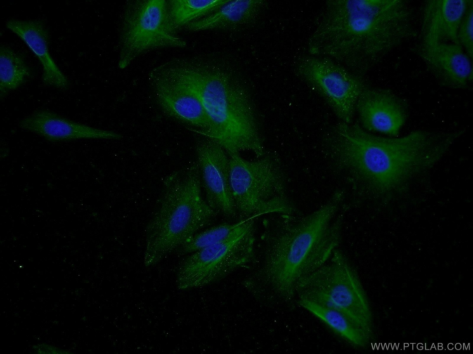 IF Staining of A549 using 25053-1-AP