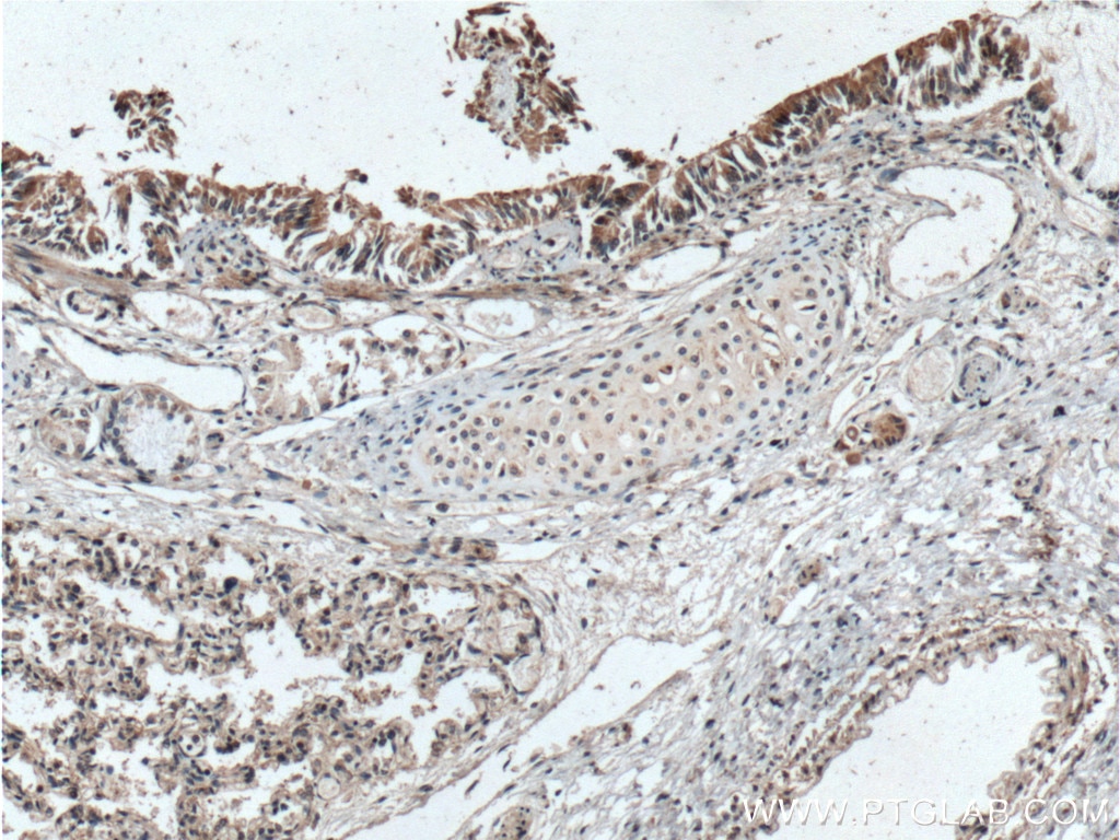 Immunohistochemistry (IHC) staining of human lung tissue using IDO2 Polyclonal antibody (25053-1-AP)