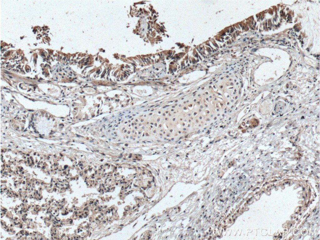 IHC staining of human lung using 25053-1-AP