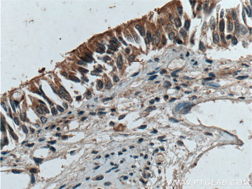 Immunohistochemistry (IHC) staining of human lung tissue using IDO2 Polyclonal antibody (25053-1-AP)