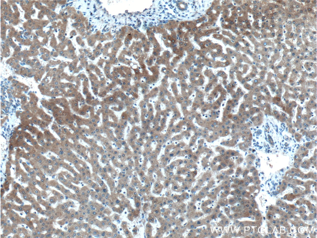 Immunohistochemistry (IHC) staining of human liver tissue using IDO2 Polyclonal antibody (25053-1-AP)