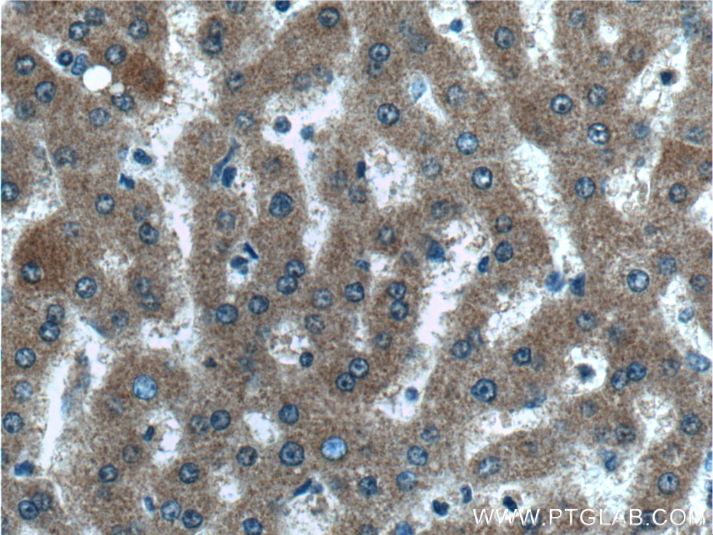 Immunohistochemistry (IHC) staining of human liver tissue using IDO2 Polyclonal antibody (25053-1-AP)