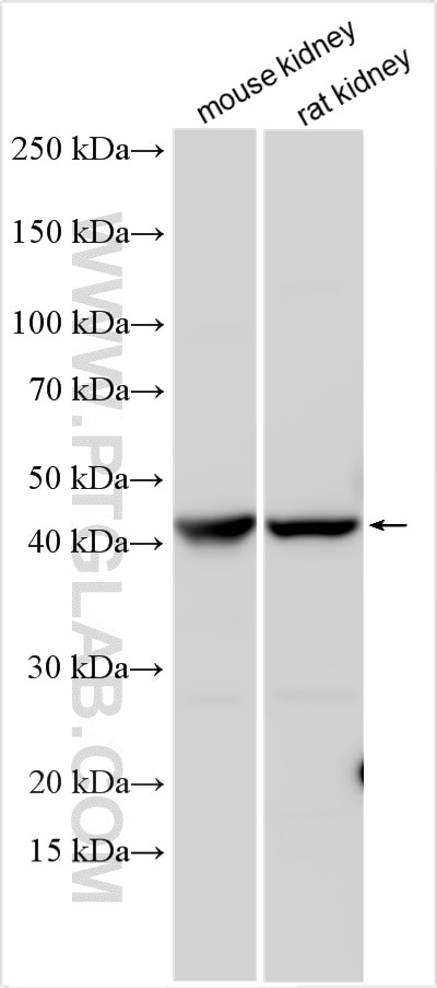 Western Blot (WB) analysis of various lysates using IDO2 Polyclonal antibody (30530-1-AP)