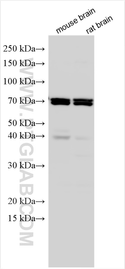 Western Blot (WB) analysis of various lysates using IDS Polyclonal antibody (29375-1-AP)