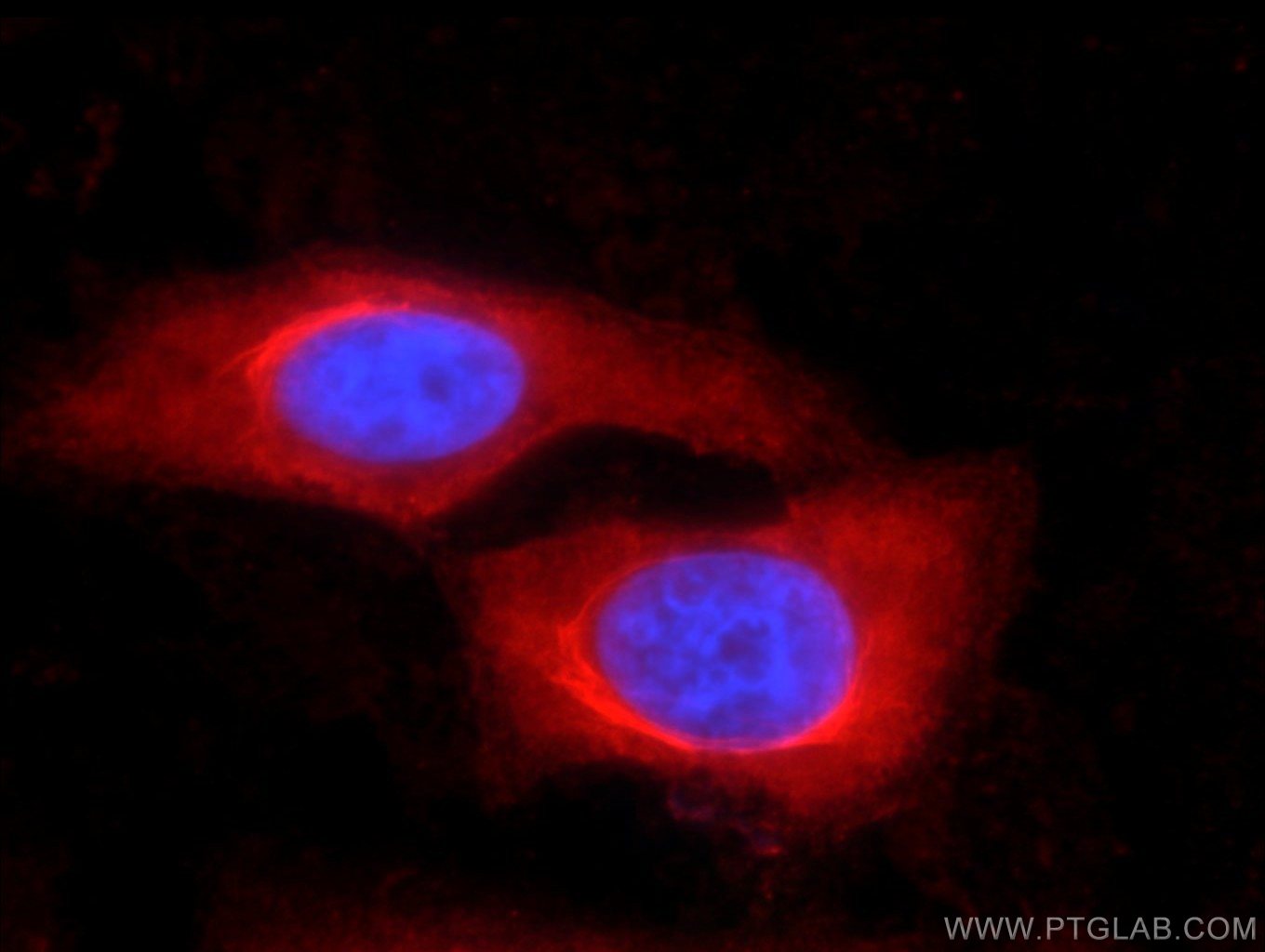 Immunofluorescence (IF) / fluorescent staining of HepG2 cells using Iduronate 2 sulfatase Monoclonal antibody (66112-1-Ig)