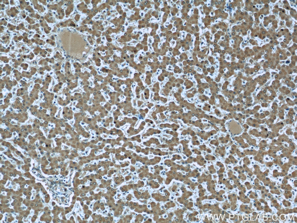 Immunohistochemistry (IHC) staining of human liver tissue using Iduronate 2 sulfatase Monoclonal antibody (66112-1-Ig)