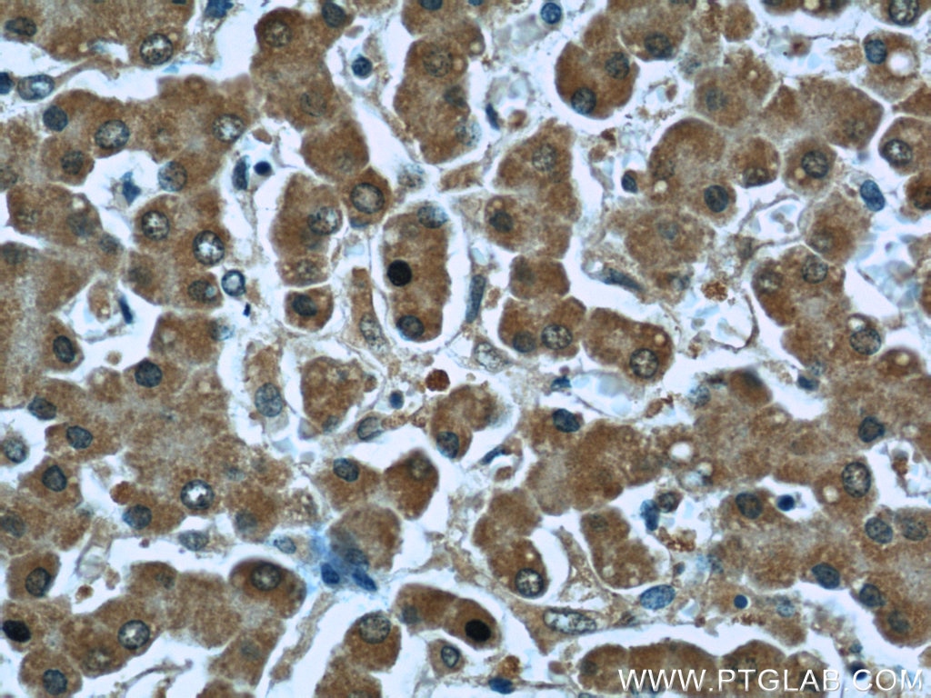 Immunohistochemistry (IHC) staining of human liver tissue using Iduronate 2 sulfatase Monoclonal antibody (66112-1-Ig)