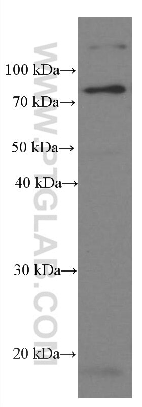 Western Blot (WB) analysis of pig brain tissue using Iduronate 2 sulfatase Monoclonal antibody (66112-1-Ig)