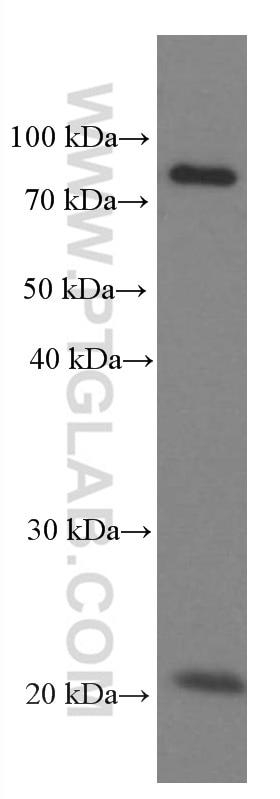 Western Blot (WB) analysis of rat brain tissue using Iduronate 2 sulfatase Monoclonal antibody (66112-1-Ig)