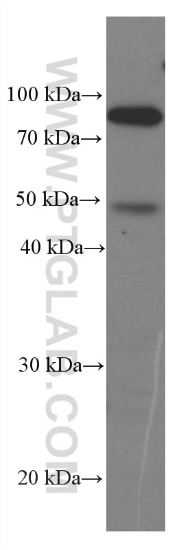 Western Blot (WB) analysis of mouse brain tissue using Iduronate 2 sulfatase Monoclonal antibody (66112-1-Ig)