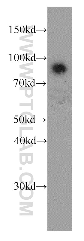 Western Blot (WB) analysis of human brain tissue using Iduronate 2 sulfatase Monoclonal antibody (66112-1-Ig)