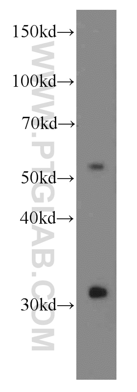 Western Blot (WB) analysis of human placenta tissue using Iduronate 2 sulfatase Monoclonal antibody (66112-1-Ig)