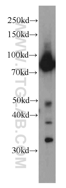 Western Blot (WB) analysis of human brain tissue using Iduronate 2 sulfatase Monoclonal antibody (66112-1-Ig)