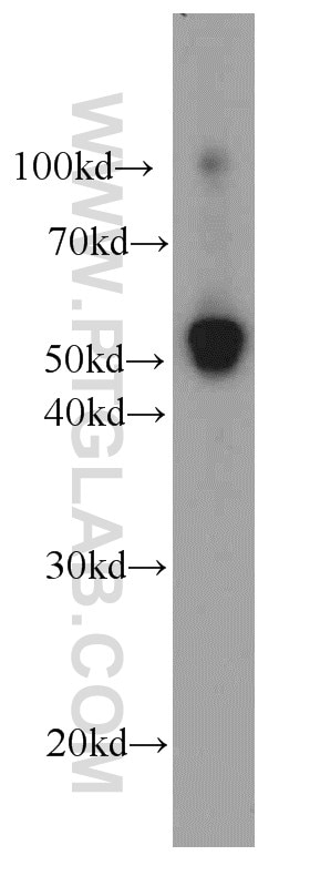 Western Blot (WB) analysis of human placenta tissue using Iduronate 2 sulfatase Monoclonal antibody (66112-1-Ig)