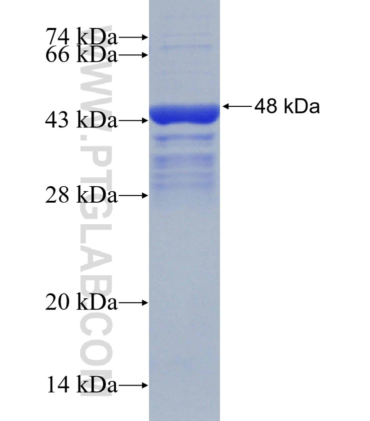 IDS fusion protein Ag31132 SDS-PAGE