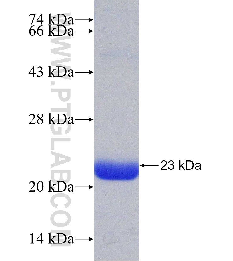 IDS fusion protein Ag31155 SDS-PAGE