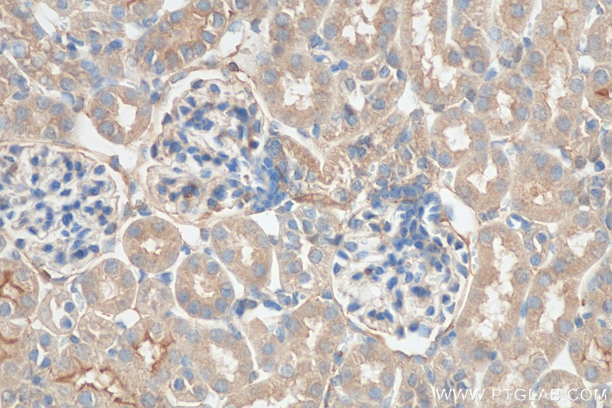 Immunohistochemistry (IHC) staining of mouse kidney tissue using IDUA Polyclonal antibody (30006-1-AP)