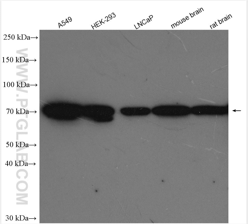 Western Blot (WB) analysis of various lysates using IDUA Polyclonal antibody (30006-1-AP)