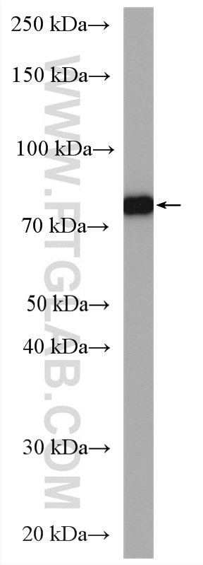 Western Blot (WB) analysis of mouse brain tissue using IDUA Polyclonal antibody (55158-1-AP)