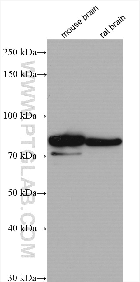 Western Blot (WB) analysis of various lysates using IDUA Polyclonal antibody (55158-1-AP)