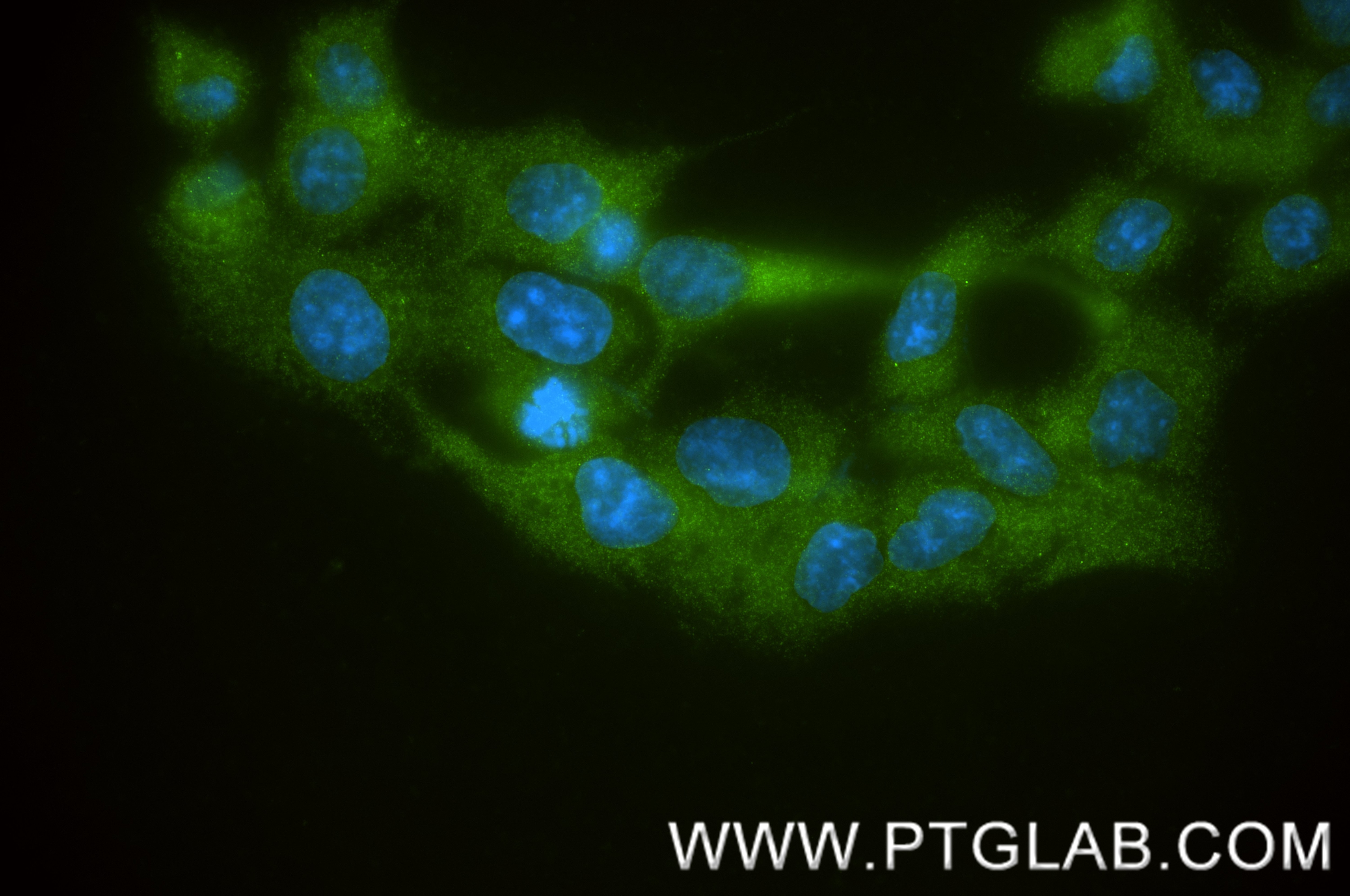 Immunofluorescence (IF) / fluorescent staining of LNCaP cells using IDUA Recombinant monoclonal antibody (86499-1-RR)