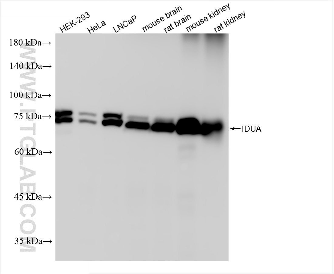 Western Blot (WB) analysis of various lysates using IDUA Recombinant antibody (86499-1-RR)