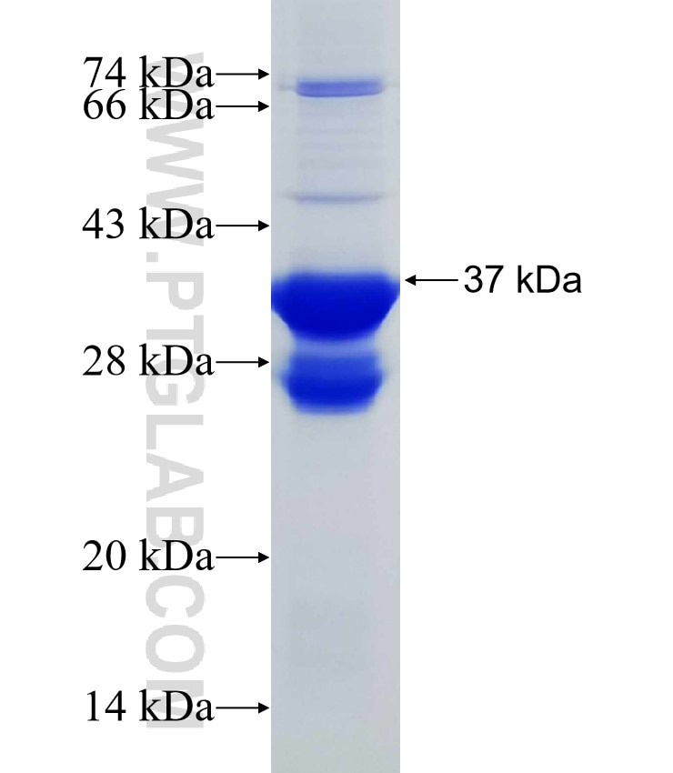 IDUA fusion protein Ag30658 SDS-PAGE