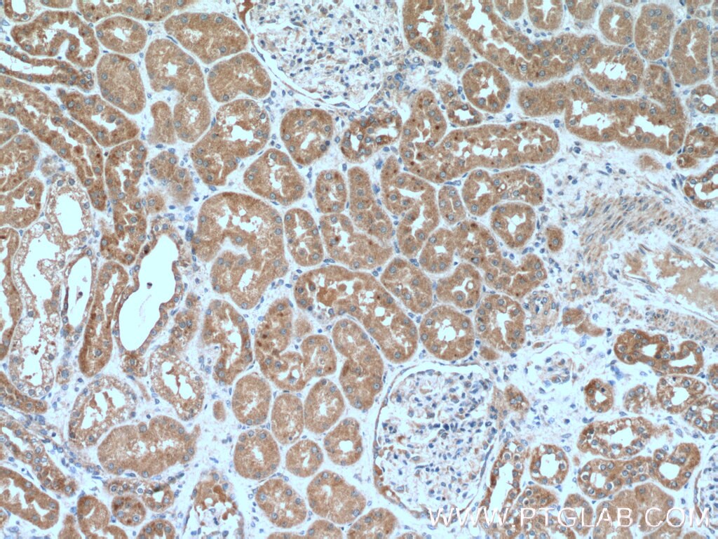 Immunohistochemistry (IHC) staining of human kidney tissue using IER2 Polyclonal antibody (23849-1-AP)