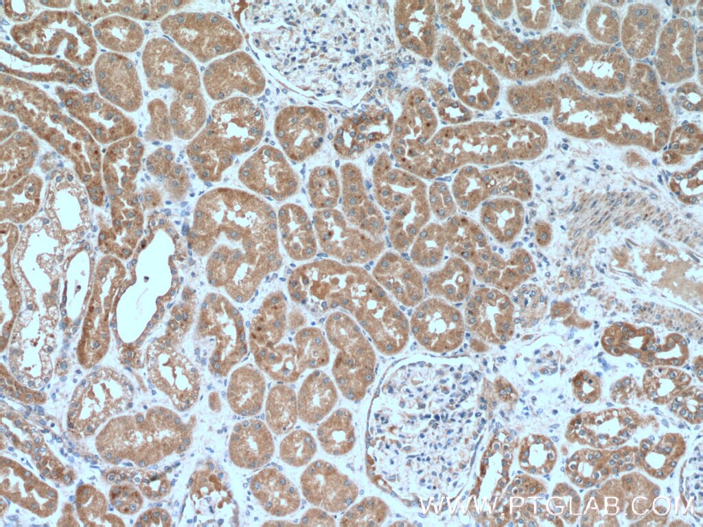 IHC staining of human kidney using 23849-1-AP