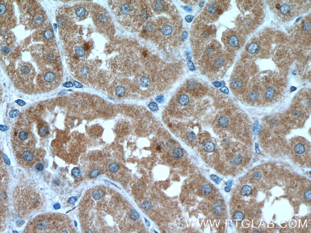 Immunohistochemistry (IHC) staining of human kidney tissue using IER2 Polyclonal antibody (23849-1-AP)