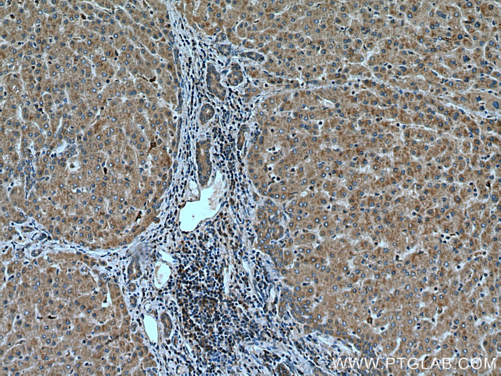 Immunohistochemistry (IHC) staining of human liver tissue using IER2 Polyclonal antibody (23849-1-AP)
