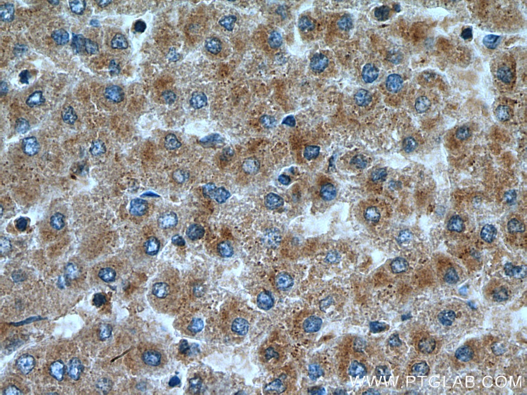 Immunohistochemistry (IHC) staining of human liver tissue using IER2 Polyclonal antibody (23849-1-AP)