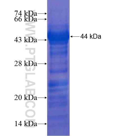 IER2 fusion protein Ag20869 SDS-PAGE