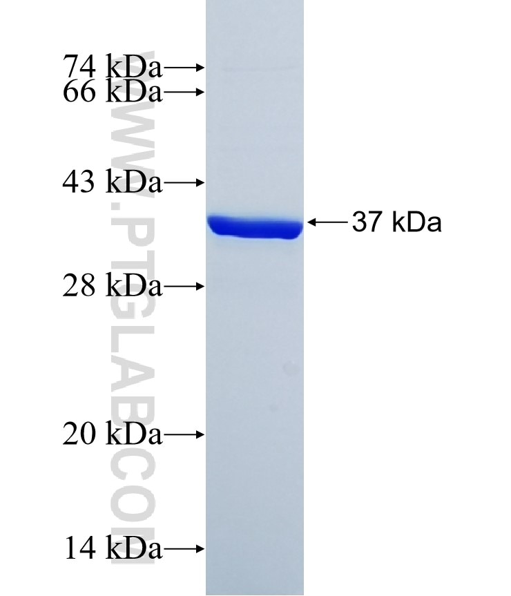 IER3 fusion protein Ag34500 SDS-PAGE IER3 fusion protein Ag34500 SDS-PAGE