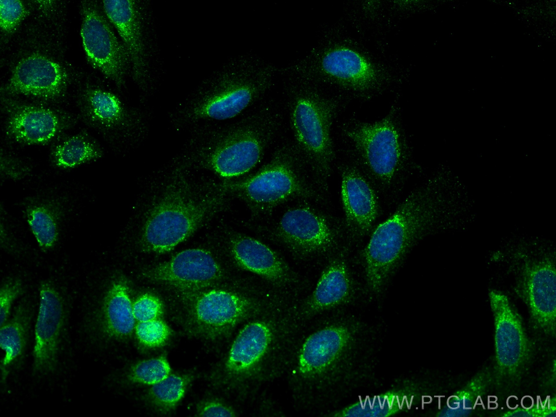 Immunofluorescence (IF) / fluorescent staining of U2OS cells using IER3IP1 Polyclonal antibody (29402-1-AP)