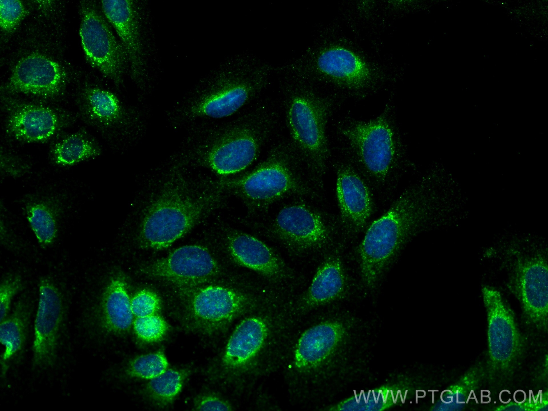 IF Staining of U2OS using 29402-1-AP