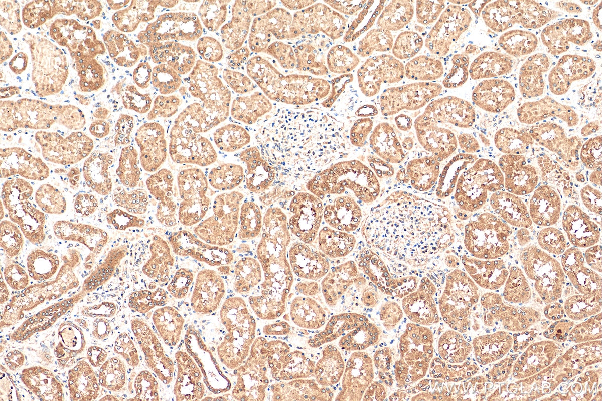 Immunohistochemistry (IHC) staining of human kidney tissue using IER3IP1 Polyclonal antibody (29402-1-AP)