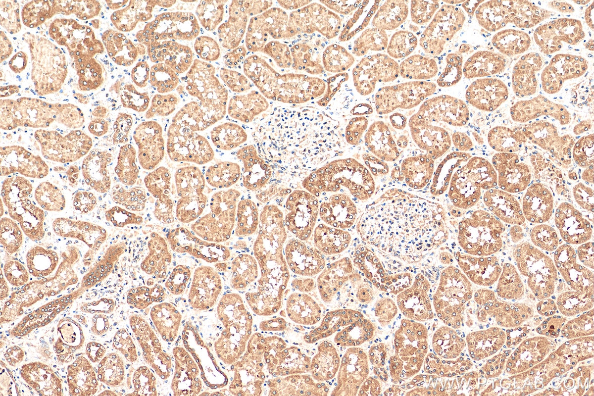 IHC staining of human kidney using 29402-1-AP