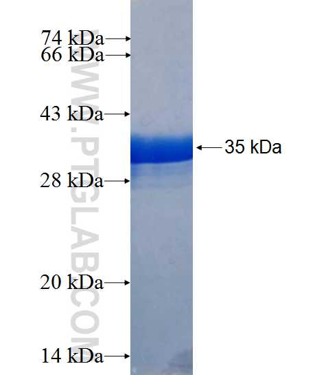 IER5 fusion protein Ag26572 SDS-PAGE