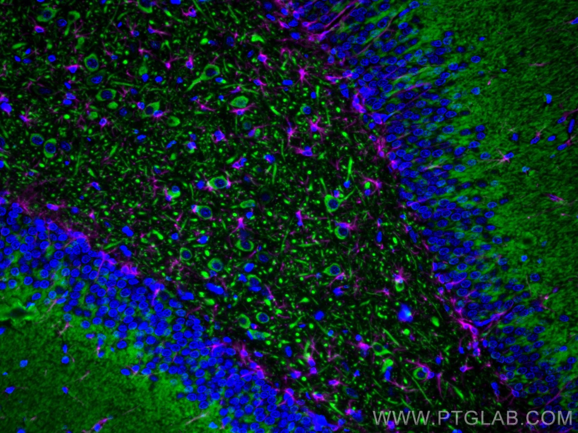 Immunofluorescence of rat brain: FFPE rat brain sections were stained with anti-MAP2 antibody (17490-1-AP, green) labeled with FlexAble HRP Antibody Labeling Kit for Rabbit IgG (KFA005) and Tyramide-488, and anti-GFAP antibody (60190-1-AP, magenta) labeled with FlexAble HRP Antibody Labeling Kit for Mouse IgG2a (KFA045) and Tyramide-650. Cell nuclei are in blue.