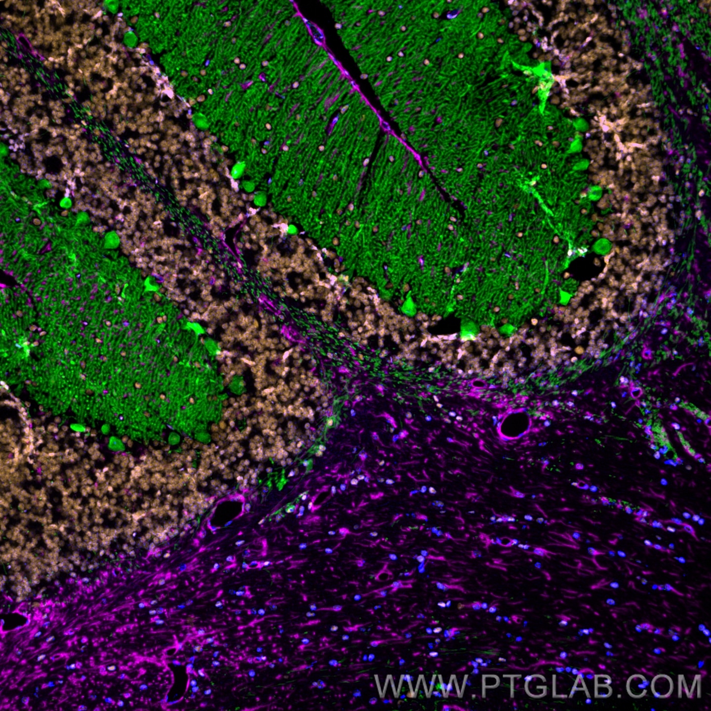 Immunofluorescence of mouse cerebellum: FFPE mouse cerebellum sections were stained with anti-Calbindin antibody (14479-1-AP, green) labeled with FlexAble HRP Antibody Labeling Kit for Rabbit IgG (KFA005) and Tyramide-488, anti-FUS antibody (68262-1-Ig, orange) labeled with FlexAble HRP Antibody Labeling Kit for Mouse IgG1 (KFA025) and Tyramide-555, and anti-GFAP antibody (60190-1-Ig, magenta) labeled with FlexAble HRP Antibody Labeling Kit for Mouse IgG2a (KFA045) and Tyramide-650. Cell nuclei are in blue. 