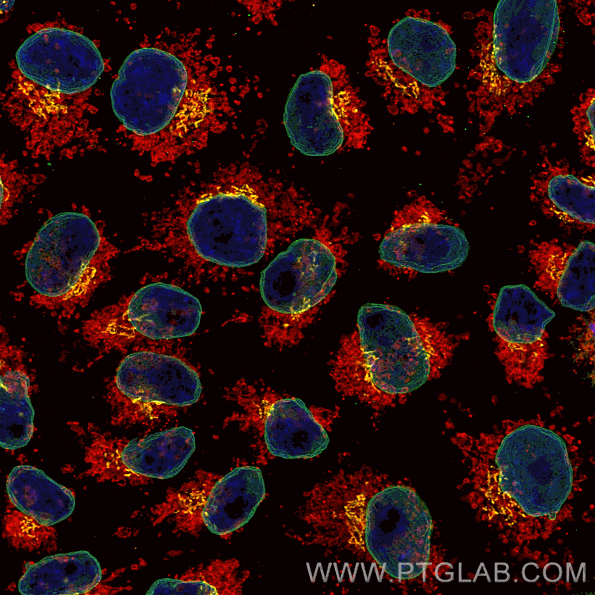 Immunofluorescence of HeLa: PFA-fixed HeLa cells were stained with anti-Lamin antibody (12987-1-AP) followed by polyclonal goat anti-rabbit AF488 secondary antibody (green), anti-GM130 antibody (11308-1-AP) labeled with FlexAble Biotin Antibody Labeling Kit (KFA007) and Streptavidin-ATTO594​ (yellow), and anti-Tom20 antibody (11802-1-AP) separately labeled with FlexAble Biotin Antibody Labeling Kit (KFA007) and Streptavidin-AQ650 (red). Nuclei are stained with DAPI (blue).
Confocal images were acquired with a 100x oil objective and post-processed. Images were recorded at the Core Facility Bioimaging at the Biomedical Center, LMU Munich.