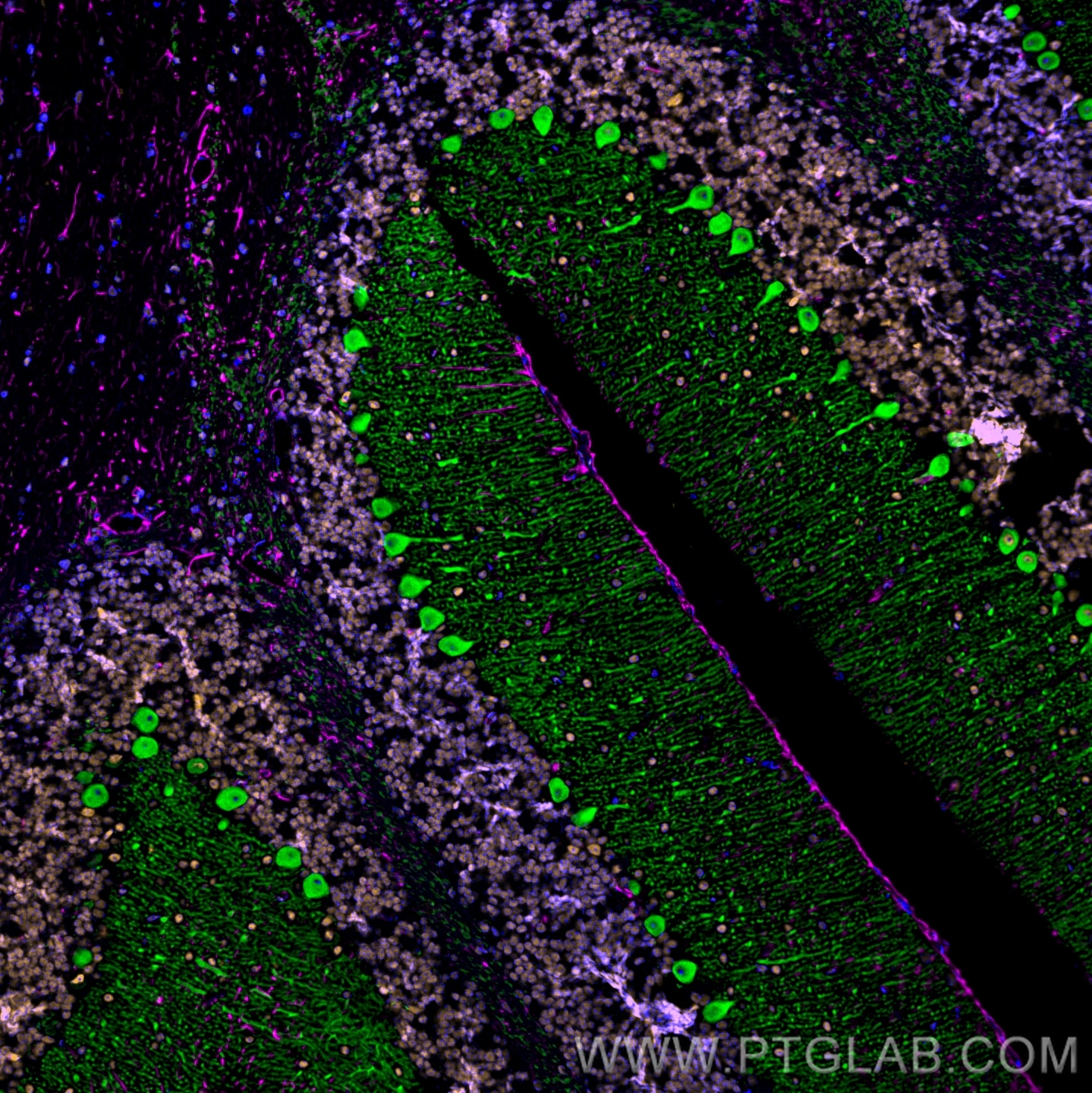 Immunofluorescence of mouse cerebellum: FFPE mouse cerebellum sections were stained with anti-Calbindin antibody (14479-1-AP, green) labeled with FlexAble HRP Antibody Labeling Kit for Rabbit IgG (KFA005) and Tyramide-488, anti-Fus antibody (68262-1-Ig, orange) labeled with FlexAble HRP Antibody Labeling Kit for Mouse IgG1 (KFA025) and Tyramide-555, and anti-GFAP antibody (60190-1-Ig, magenta) labeled with FlexAble HRP Antibody Labeling Kit for Mouse IgG2a (KFA045) and Tyramide-650. Cell nuclei are in blue.