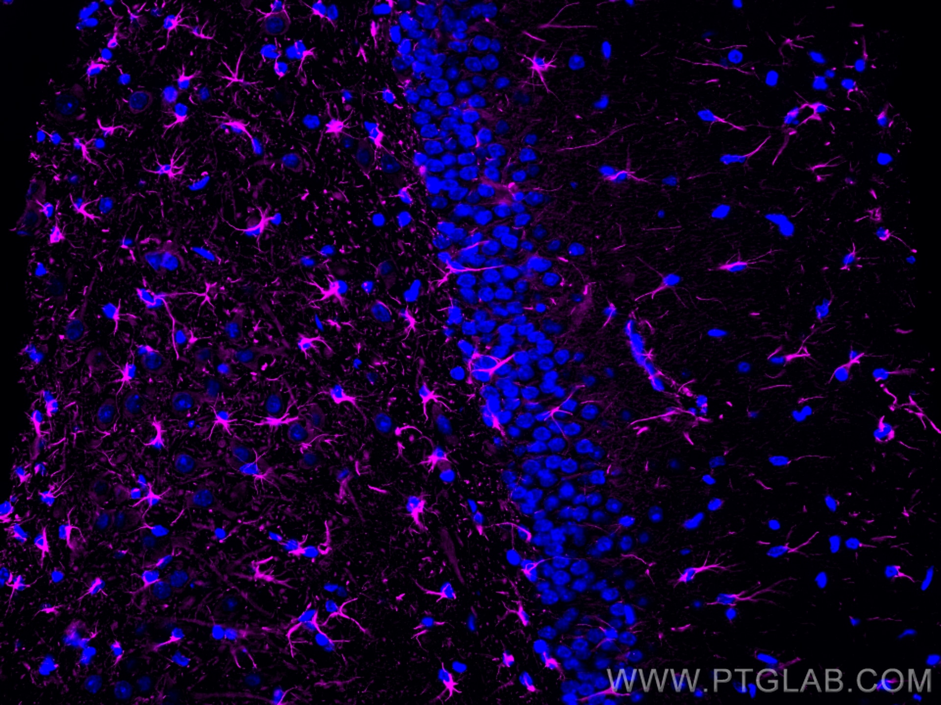 Immunofluorescence of rat brain: FFPE rat brain sections were stained with anti-GFAP antibody (60190-1-Ig) labeled with FlexAble Biotin Antibody Labeling Kit for Mouse IgG2a (KFA047) and Streptavidin-650 (magenta).  Cell nuclei are in blue.