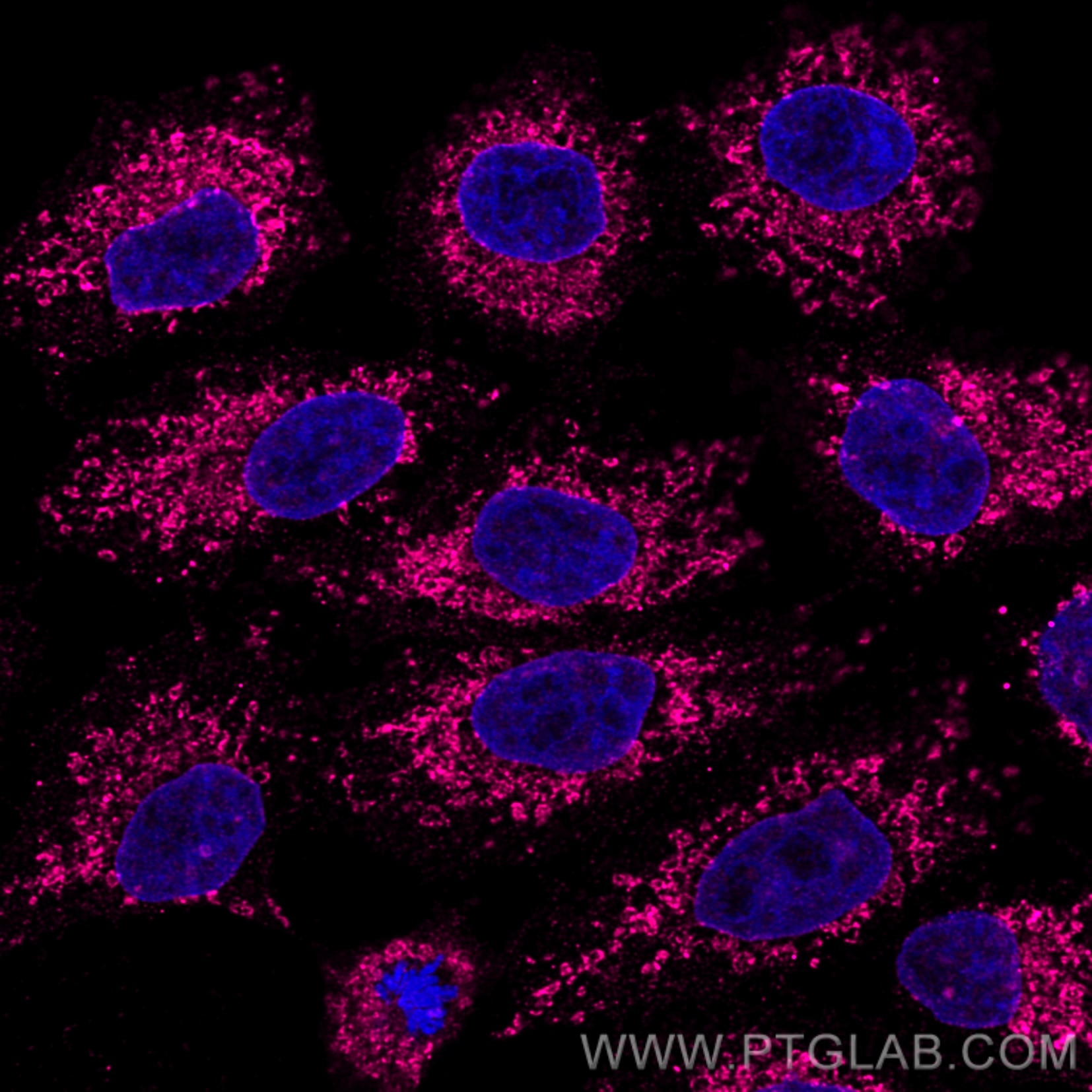 Immunofluorescence of HeLa: PFA-fixed HeLa cells were stained with anti-Tom20 (66777-1-Ig) labeled with FlexAble ​CoraLite® Plus 647 Kit (KFA063, magenta). Nuclei were stained with DAPI (blue). Confocal images were acquired with a 100x oil objective and post-processed. Images were recorded at the Core Facility Bioimaging at the Biomedical Center, LMU Munich.
