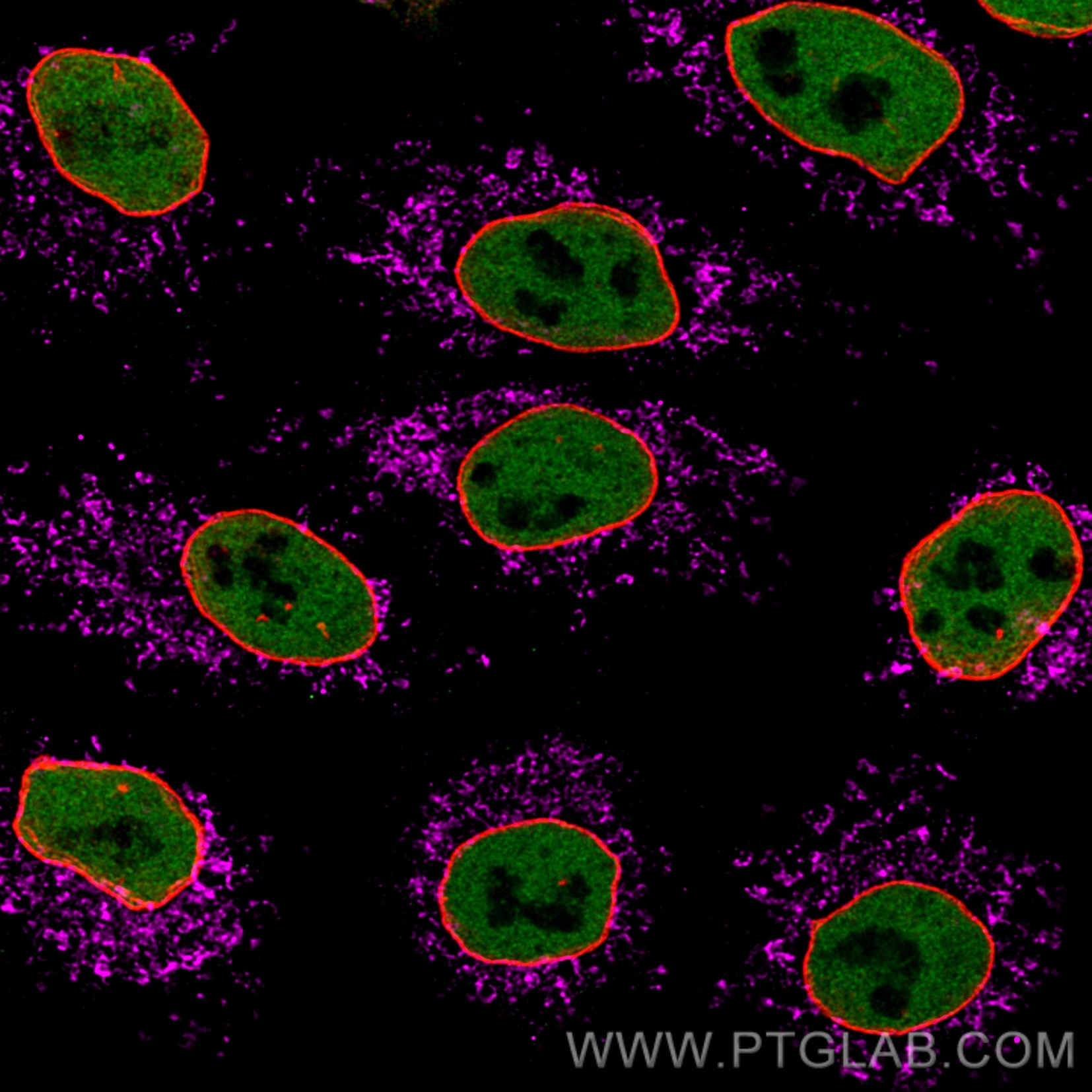 Immunofluorescence of HeLa: PFA-fixed HeLa cells were stained with anti-HDAC2 (676165-1-Ig) labeled with FlexAble CoraLite® Plus 488 Kit (KFA061, green), mouse IgG2b anti-Lamin primary and anti-mouse IgG secondary antibody Alexa Fluor® 568 (red) and anti-Tom20 (66777-1-Ig) labeled with FlexAble ​CoraLite® Plus 647 Kit (KFA063, magenta). Confocal images were acquired with a 100x oil objective and post-processed. Images were recorded at the Core Facility Bioimaging at the Biomedical Center, LMU Munich.