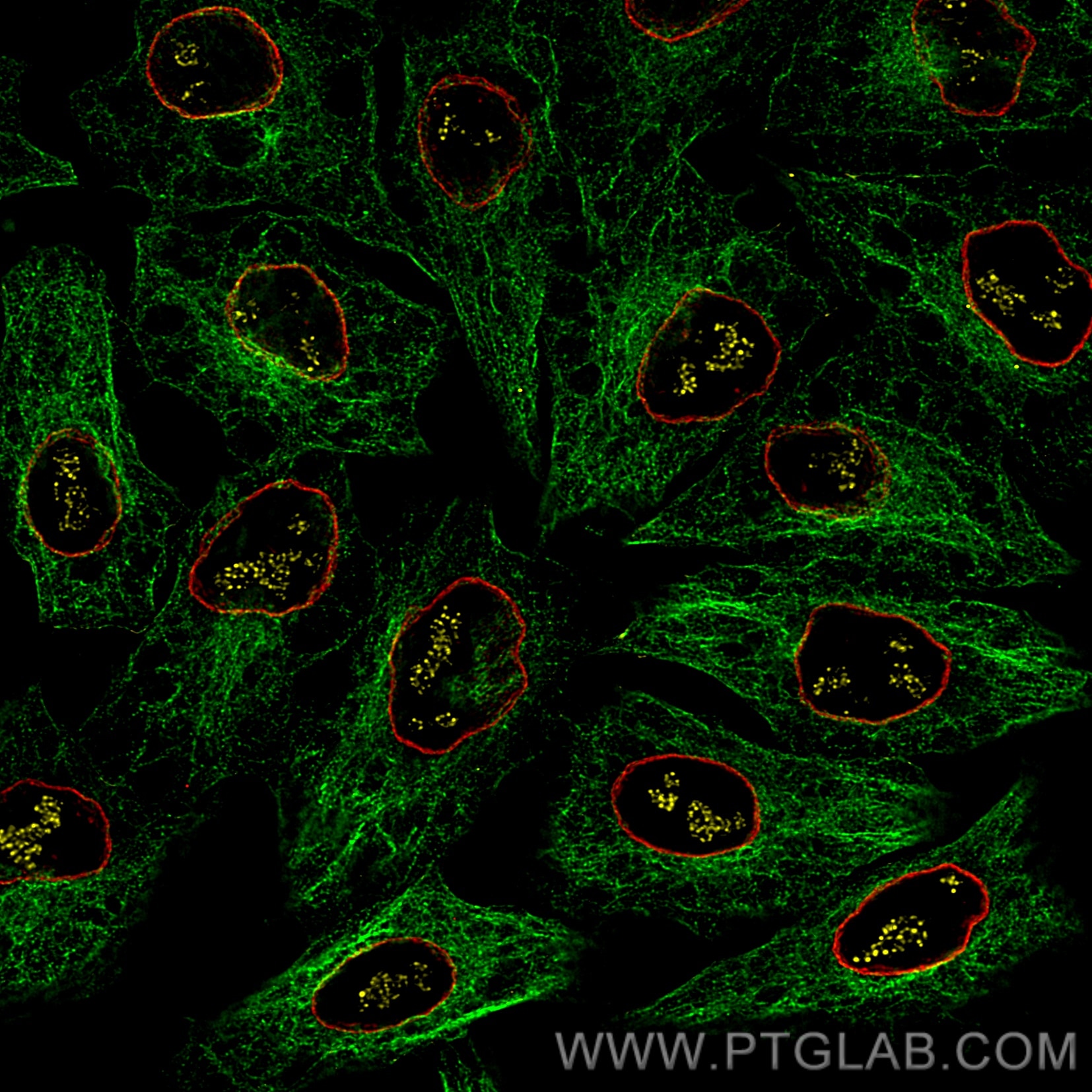 Immunofluorescence of HeLa: PFA-fixed HeLa cells were stained with anti-Tubulin antibody labeled with FlexAble CoraLite® Plus 488 Kit (KFA061, green), anti-Lamin antibody labeled with FlexAble CoraLite® Plus 555 Kit (KFA062, red) and anti-PAF49 antibody labeled with FlexAble CoraLite® Plus 647 Kit (KFA063, yellow). Confocal images were acquired with a 100x oil objective and post-processed. Images were recorded at the Core Facility Bioimaging at the Biomedical Center, LMU Munich.