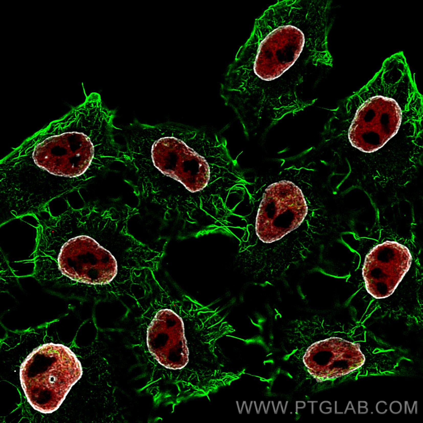 Immunofluorescence of HeLa: PFA-fixed HeLa cells were stained with anti-Actin antibody labeled with FlexAble CoraLite® Plus 488 Kit (KFA041, green), anti-HDAC2 (67165-1-Ig) labeled with FlexAble CoraLite® Plus 555 Kit (KFA062, red) and anti-Lamin antibody labeled with FlexAble CoraLite® Plus 647 Kit (KFA063, grey). Confocal images were acquired with a 100x oil objective and post-processed. Images were recorded at the Core Facility Bioimaging at the Biomedical Center, LMU Munich.