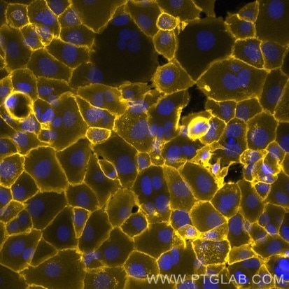 Live A431 cells were immunostained with anti-EGFR (cetuximab biosimilar) labeled with FlexAble CoraLite Plus 555 Antibody Labeling Kit for Human IgG (KFA105). Nuclei are in blue.​  Epifluorescence images were acquired with a 20x objective and post-processed.​